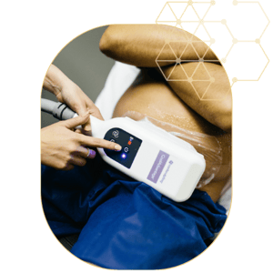 coolsculpting package v2